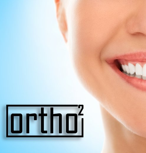 שאלות ותשובות יישור שיניים